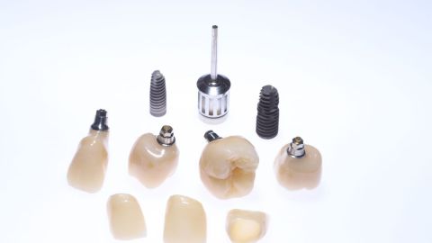 Stomatológia Aupark Košice - HAPPYDENT