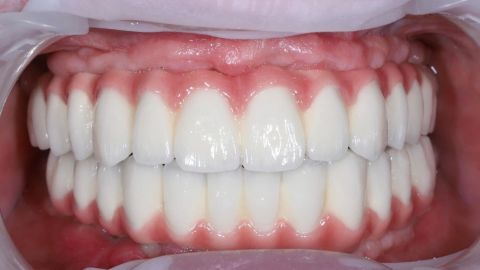 Stomatológia Aupark Košice - HAPPYDENT