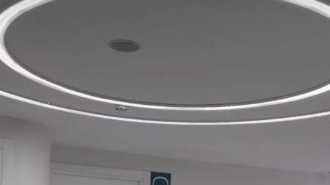 Transplantácia vlasov Turecko