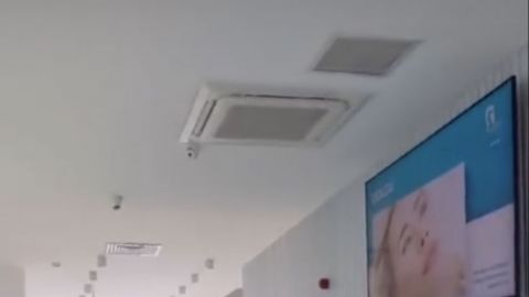 Transplantácia vlasov Turecko